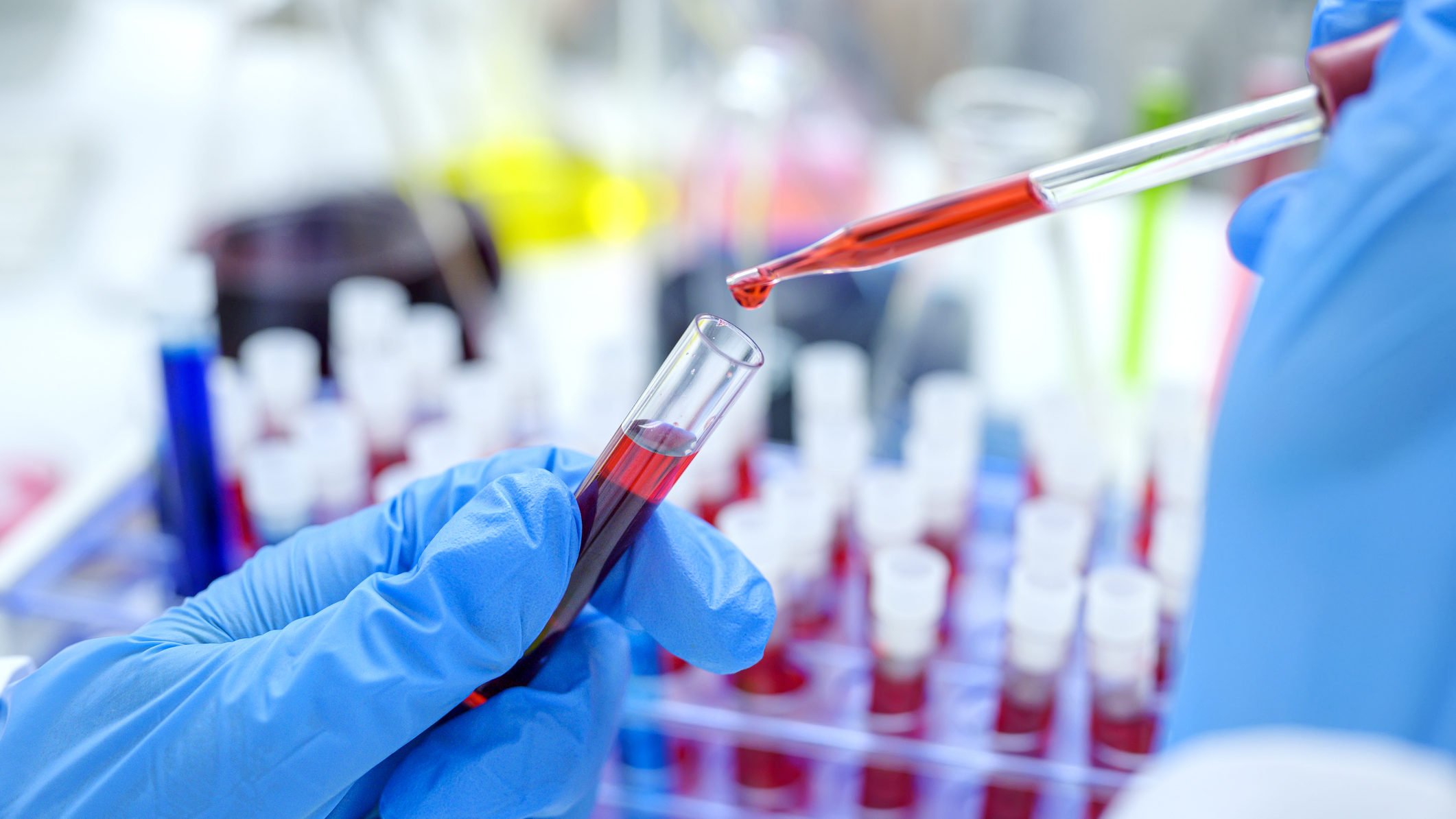 New Blood Test Detects 50 Types of Cancer Before Any Clinical Signs