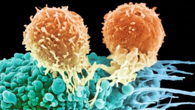 Micrograph of 2 white blood cells on tumor cell