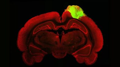 minibrain in injured rat brain