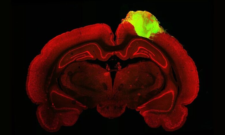 minibrain in injured rat brain