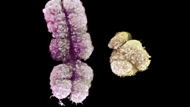 X and Y chromosome