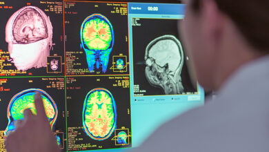 Woman looking at brain scan