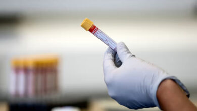 Tube with blood test in hand with glove close up