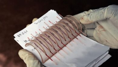 Medical screening campaign for sleeping sickness in Chad.