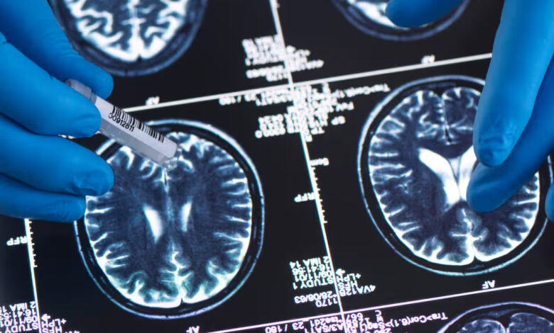 Brain scans