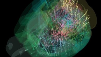 Brain scan that shows where decisions are made in the brain