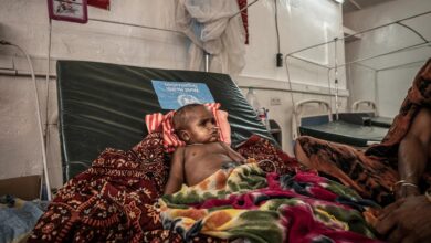 Baby in Sudan with meningitis