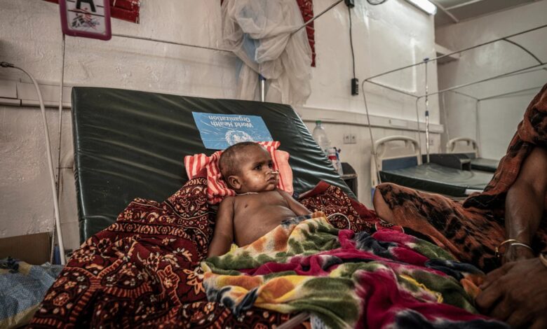 Baby in Sudan with meningitis