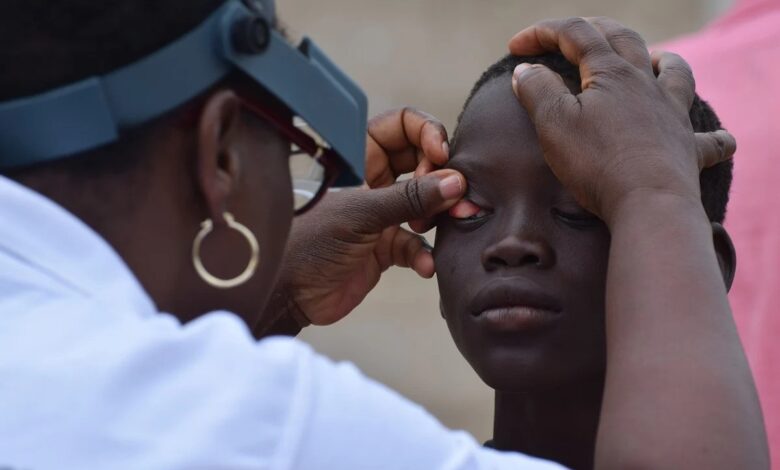 A young boy's eyes are examined for signs of trachoma during a Tropical Data Training in Senegal.