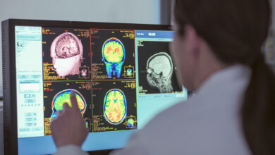 UK, North Yorkshire, Female doctor looking at MRI scanner monitor