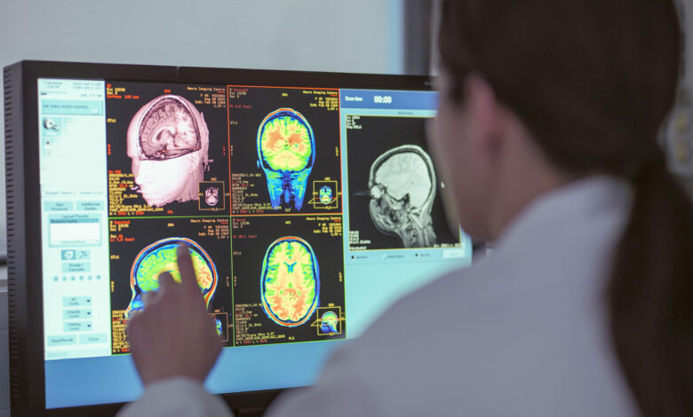 UK, North Yorkshire, Female doctor looking at MRI scanner monitor