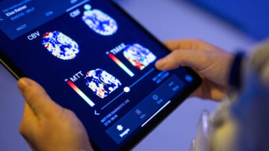 Artificial intelligence in the hospital