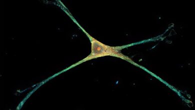 Single rat astrocyte