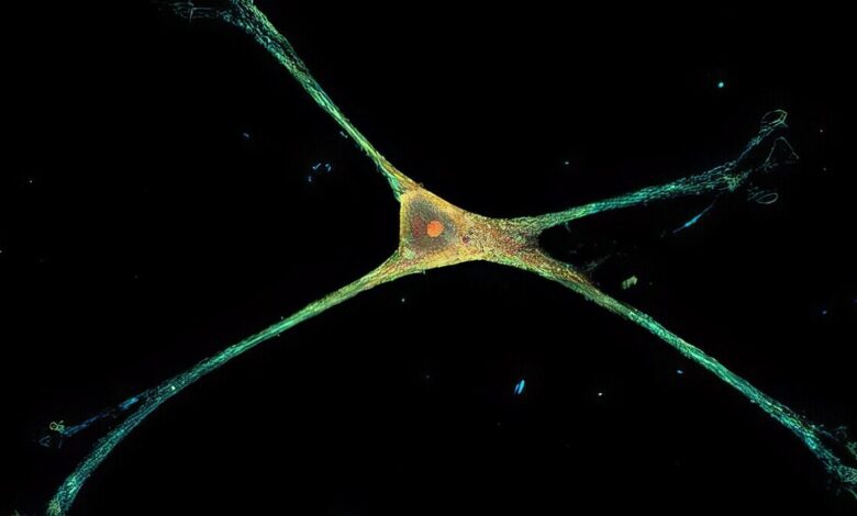 Single rat astrocyte