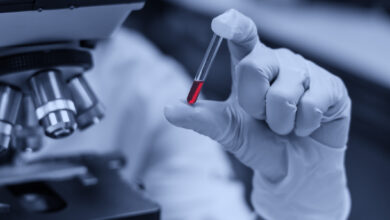 the scientist is analyzing the blood sample in laboratory