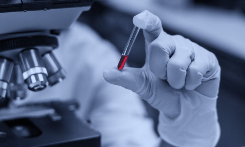 the scientist is analyzing the blood sample in laboratory
