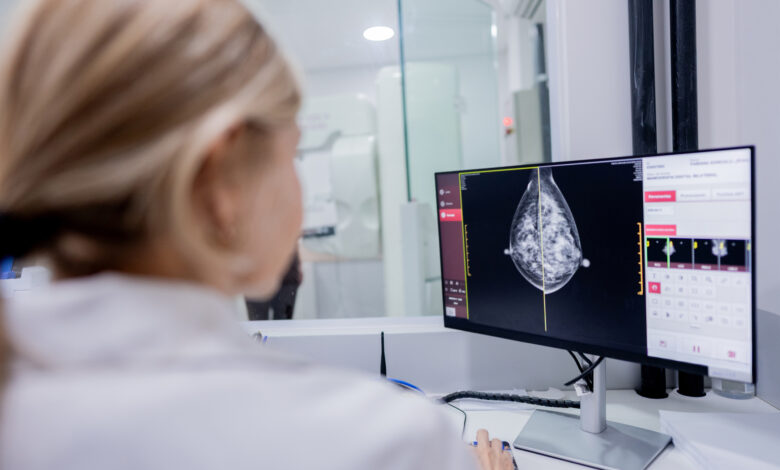 Doctor examining mammography scan on hospital computer