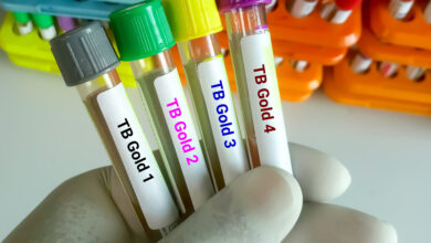 Close view of scientist hand hold blood samples for TB Gold or Quantiferon test. 4 sampless for TB test. diagnosis for mycobacterium tuberculosis infection