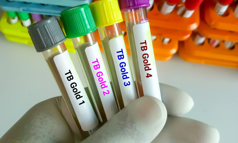 Close view of scientist hand hold blood samples for TB Gold or Quantiferon test. 4 sampless for TB test. diagnosis for mycobacterium tuberculosis infection